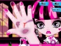 Game Draculaura Hand Doctor