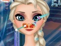 Game Frozen Elsa Nose Doctor