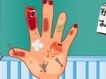 Game Hand Surgery