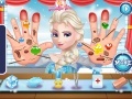 Game Frozen Elsa Hand Doctor