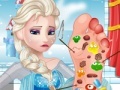 Game Elsa foot doctor