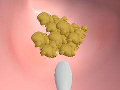 Game Earwax Clinic online.